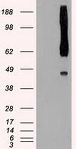 RAD9 Antibody in Western Blot (WB)