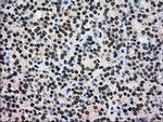 GCK Antibody in Immunohistochemistry (Paraffin) (IHC (P))