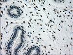 GCK Antibody in Immunohistochemistry (Paraffin) (IHC (P))