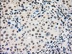 GCK Antibody in Immunohistochemistry (Paraffin) (IHC (P))