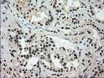 GCK Antibody in Immunohistochemistry (Paraffin) (IHC (P))