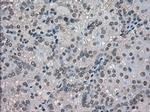 VMAT2 Antibody in Immunohistochemistry (Paraffin) (IHC (P))