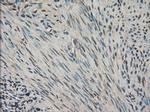 VMAT2 Antibody in Immunohistochemistry (Paraffin) (IHC (P))