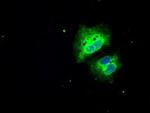 SLC7A8 Antibody in Immunocytochemistry (ICC/IF)