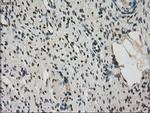 Kindlin 2 Antibody in Immunohistochemistry (Paraffin) (IHC (P))