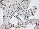 Kindlin 2 Antibody in Immunohistochemistry (Paraffin) (IHC (P))