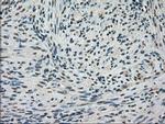 Kindlin 2 Antibody in Immunohistochemistry (Paraffin) (IHC (P))