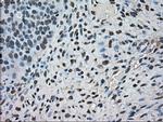 Kindlin 2 Antibody in Immunohistochemistry (Paraffin) (IHC (P))