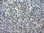 TRIB2 Antibody in Immunohistochemistry (Paraffin) (IHC (P))