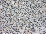 TRIB2 Antibody in Immunohistochemistry (Paraffin) (IHC (P))