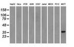 TRIB2 Antibody in Western Blot (WB)