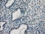 DHFR Antibody in Immunohistochemistry (Paraffin) (IHC (P))