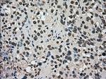 DHFR Antibody in Immunohistochemistry (Paraffin) (IHC (P))