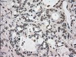 DHFR Antibody in Immunohistochemistry (Paraffin) (IHC (P))