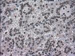 DHFR Antibody in Immunohistochemistry (Paraffin) (IHC (P))