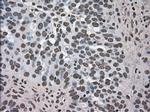 DHFR Antibody in Immunohistochemistry (Paraffin) (IHC (P))