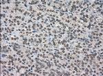 DHFR Antibody in Immunohistochemistry (Paraffin) (IHC (P))