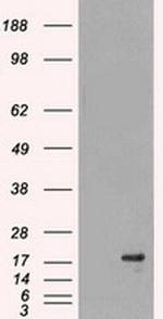 DHFR Antibody in Western Blot (WB)