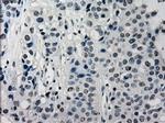 SATB1 Antibody in Immunohistochemistry (Paraffin) (IHC (P))