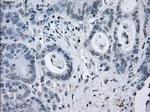 SATB1 Antibody in Immunohistochemistry (Paraffin) (IHC (P))