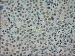 NEK6 Antibody in Immunohistochemistry (Paraffin) (IHC (P))