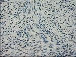 NEK6 Antibody in Immunohistochemistry (Paraffin) (IHC (P))