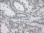 NAT8 Antibody in Immunohistochemistry (Paraffin) (IHC (P))