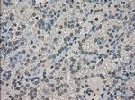 DHFR Antibody in Immunohistochemistry (Paraffin) (IHC (P))