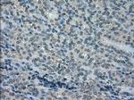 DHFR Antibody in Immunohistochemistry (Paraffin) (IHC (P))