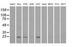 DHFR Antibody in Western Blot (WB)