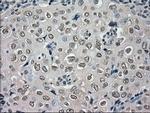 NEK6 Antibody in Immunohistochemistry (Paraffin) (IHC (P))