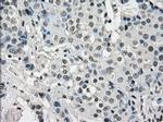 JMJD2C Antibody in Immunohistochemistry (Paraffin) (IHC (P))