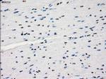 JMJD2C Antibody in Immunohistochemistry (Paraffin) (IHC (P))