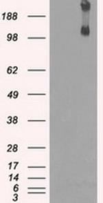 JMJD2C Antibody in Western Blot (WB)