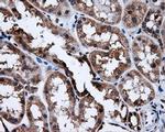 SATB1 Antibody in Immunohistochemistry (Paraffin) (IHC (P))