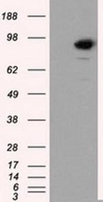 SATB1 Antibody in Western Blot (WB)