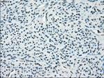 PP5 Antibody in Immunohistochemistry (Paraffin) (IHC (P))