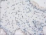 PP5 Antibody in Immunohistochemistry (Paraffin) (IHC (P))