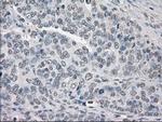 PP5 Antibody in Immunohistochemistry (Paraffin) (IHC (P))