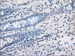 PP5 Antibody in Immunohistochemistry (Paraffin) (IHC (P))