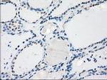 PP5 Antibody in Immunohistochemistry (Paraffin) (IHC (P))