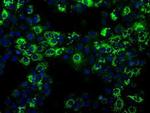 ALDH2 Antibody in Immunocytochemistry (ICC/IF)