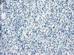 Fra1 Antibody in Immunohistochemistry (Paraffin) (IHC (P))