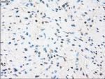 ZFP36 Antibody in Immunohistochemistry (Paraffin) (IHC (P))