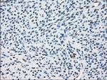 ZFP36 Antibody in Immunohistochemistry (Paraffin) (IHC (P))