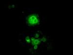 Cytochrome P450 Reductase Antibody in Immunocytochemistry (ICC/IF)