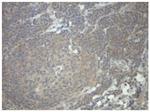 PRKAR1A Antibody in Immunohistochemistry (Paraffin) (IHC (P))