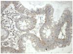 PRKAR1A Antibody in Immunohistochemistry (Paraffin) (IHC (P))