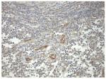 PRKAR1A Antibody in Immunohistochemistry (Paraffin) (IHC (P))