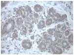 PRKAR1A Antibody in Immunohistochemistry (Paraffin) (IHC (P))